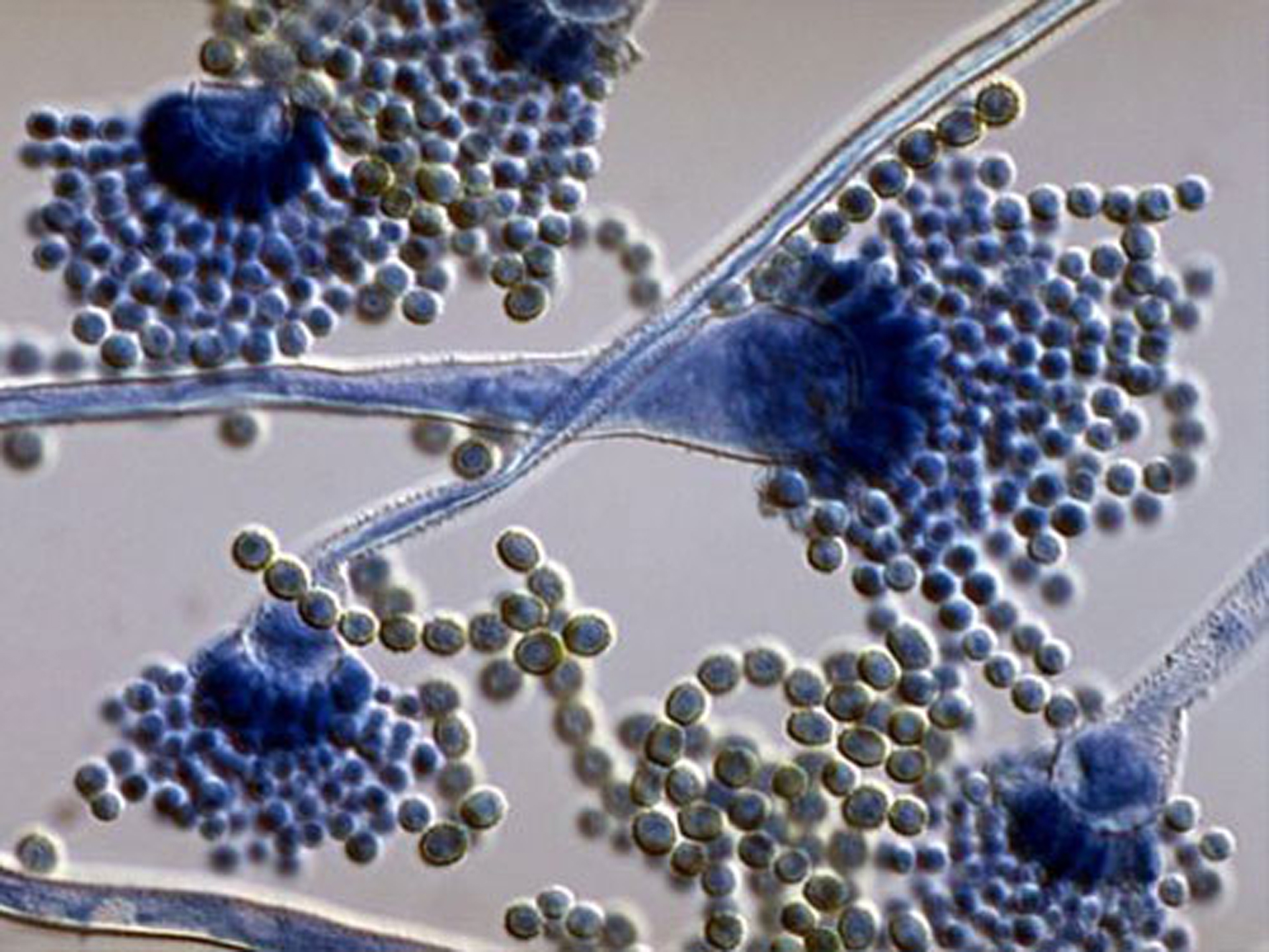 Патогенные грибы споры. Грибы Aspergillus flavus. Плесневые грибы рода Aspergillus. Aspergillus fumigatus микроскоп. Грибы аспергилл кандида.